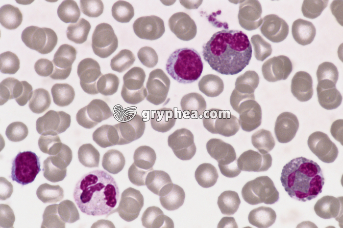 Moelle osseuse x400 - gryphea.org